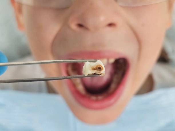 Best Emergency Dental Care for Trauma or Injury in Flemingsburg, KY